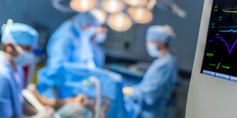 four doctors performing an operation in an operating room